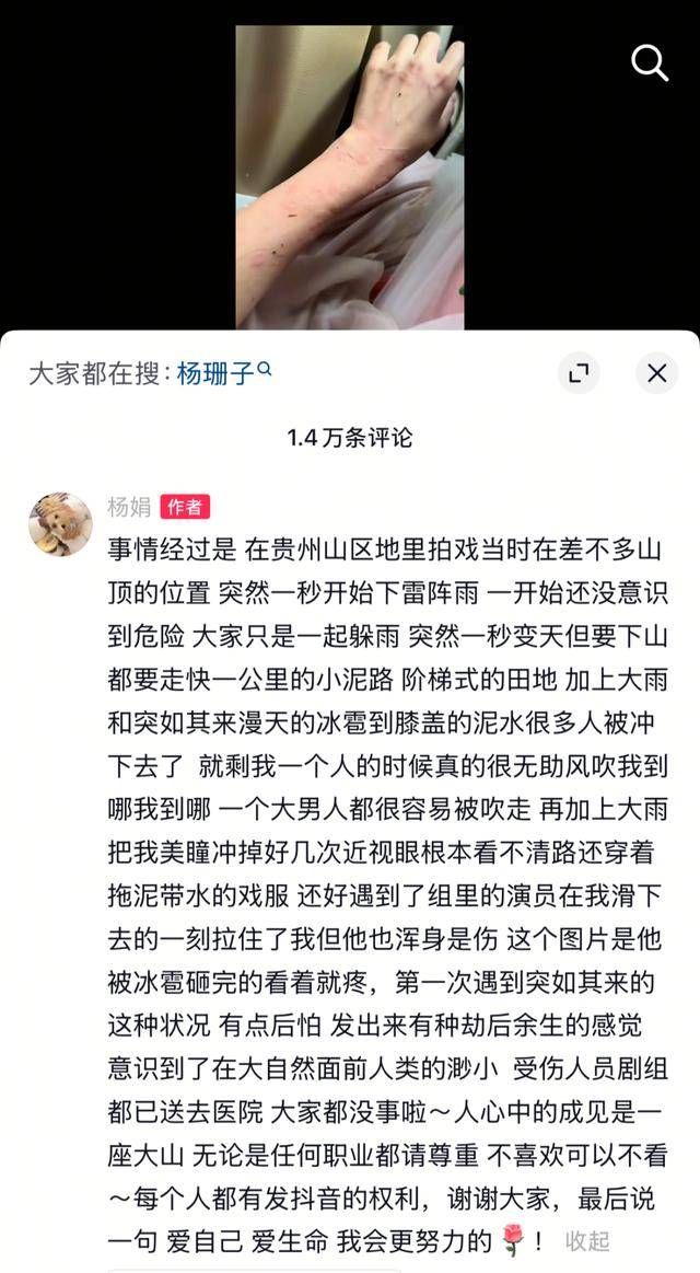 女演员贵州拍戏遇极端天气，被冰雹砸伤！剧组伤员已送医